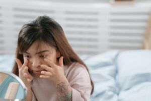 Olhos inchados pela manhã? 11 causas e tratamentos respaldados por especialistas