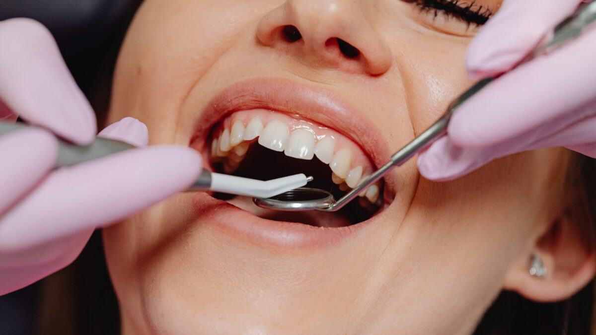 O Papel dos Suplementos de Colágeno na Saúde Oral: O Que a Ciência Revela