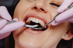O Papel dos Suplementos de Colágeno na Saúde Oral: O Que a Ciência Revela
