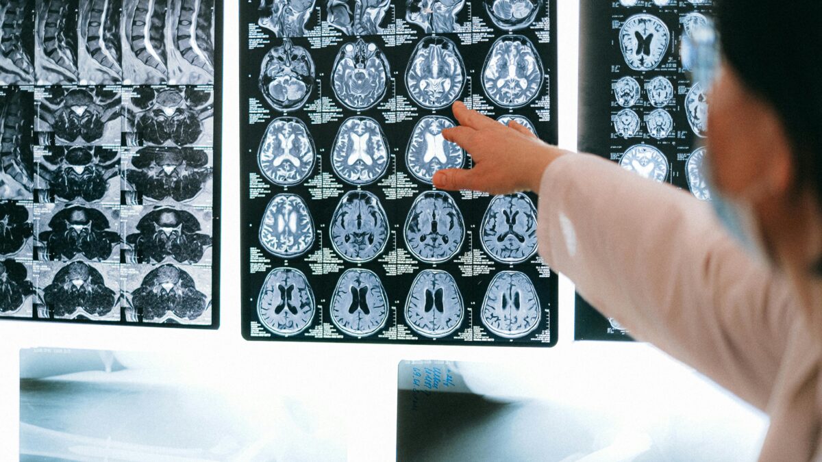 Tuberculose no Brasil: Por que a doença avança e o que podemos fazer para revertê-la?